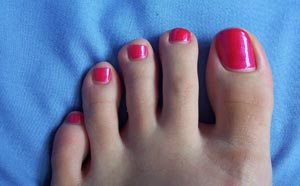 Ingrown Toenails  Northern Rivers Podiatry